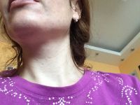 Биоревитализация инъекции красоты Киев цена
