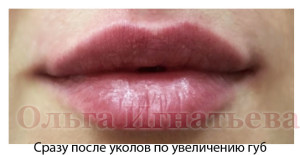 Увеличение скул больно ли