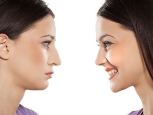 noseplasty