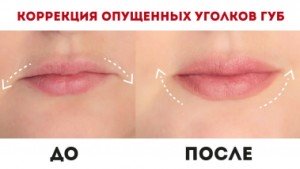 VMvbT20s