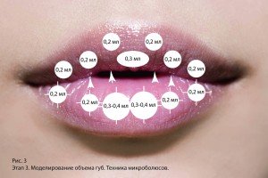 Две складки на нижней губе