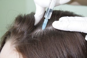 mezoterapia-
