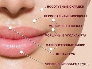 Две складки на нижней губе